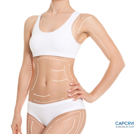 Cryolipolyse: le pack minceur