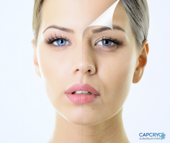 Pack 10 séances soin du visage Cryo Boost Collagène image 3