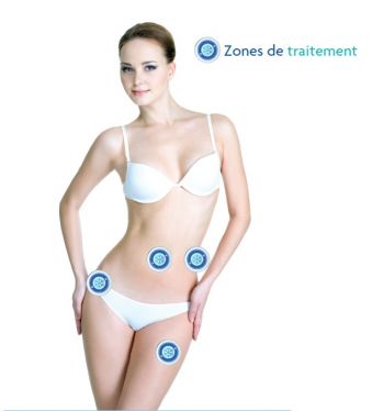 Cryolipolyse: le pack minceur image 3